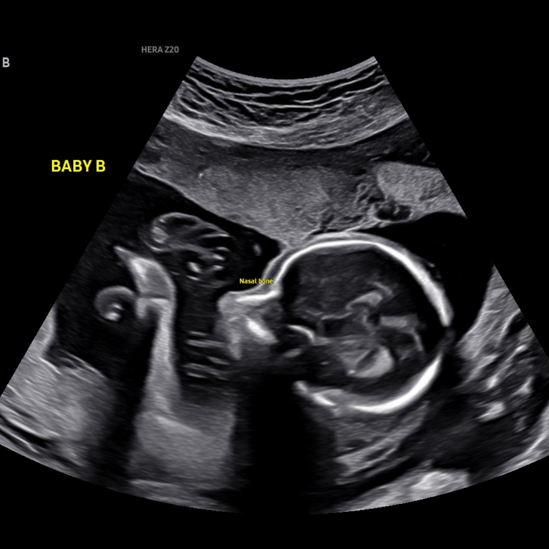 Photo shared by Ali for their Babylist baby registry.