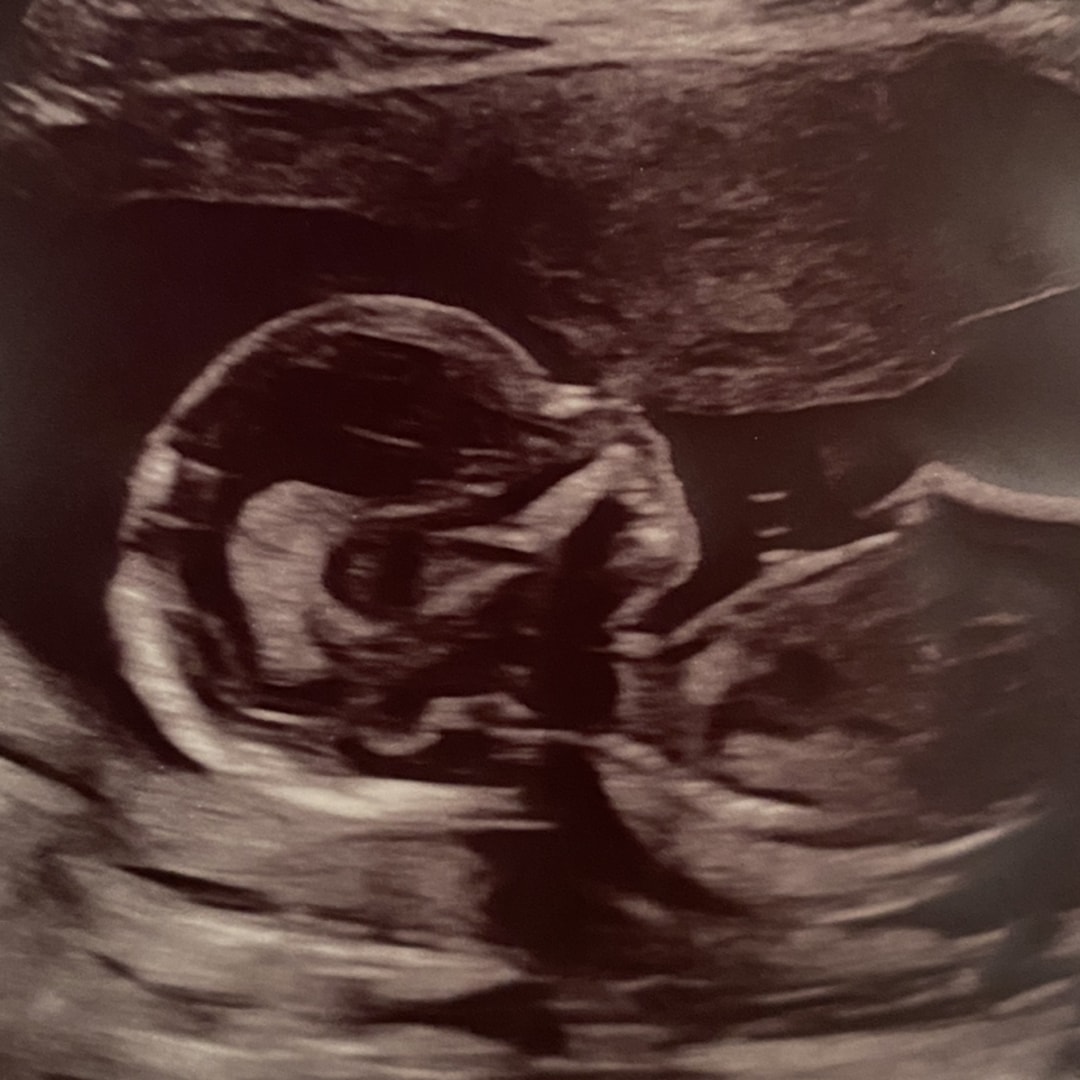 Photo shared by Ellie for their Babylist baby registry.