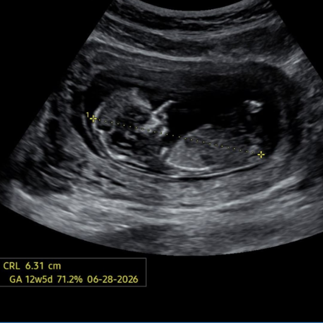 Photo shared by Haven for their Babylist baby registry.