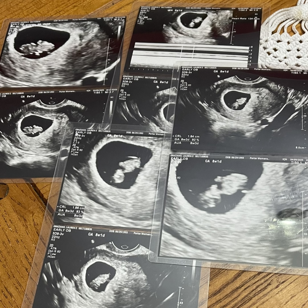 Photo shared by Lauren for their Babylist baby registry.
