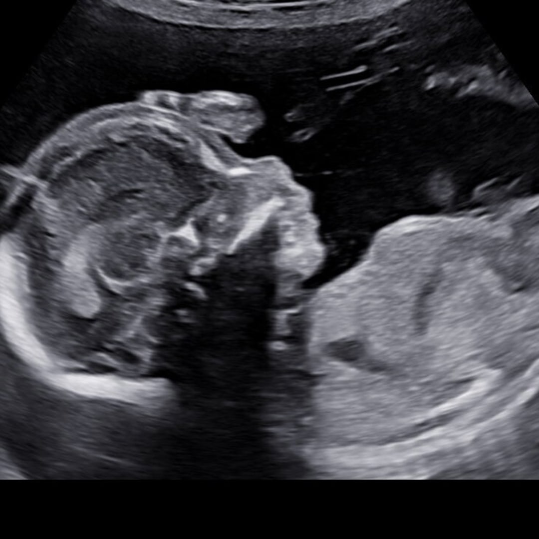 Photo shared by Kelsi for their Babylist baby registry.