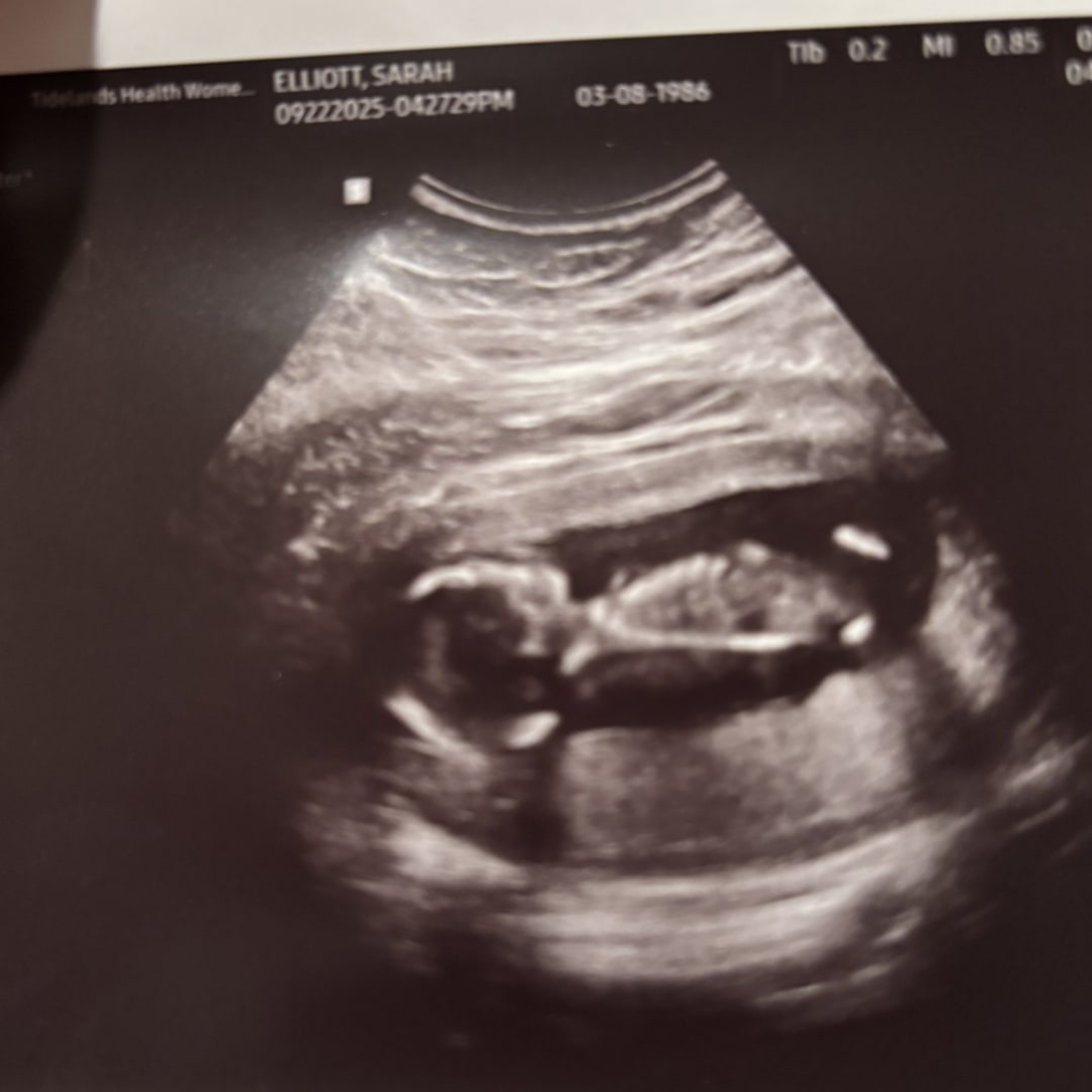 Photo shared by Sarah for their Babylist baby registry.