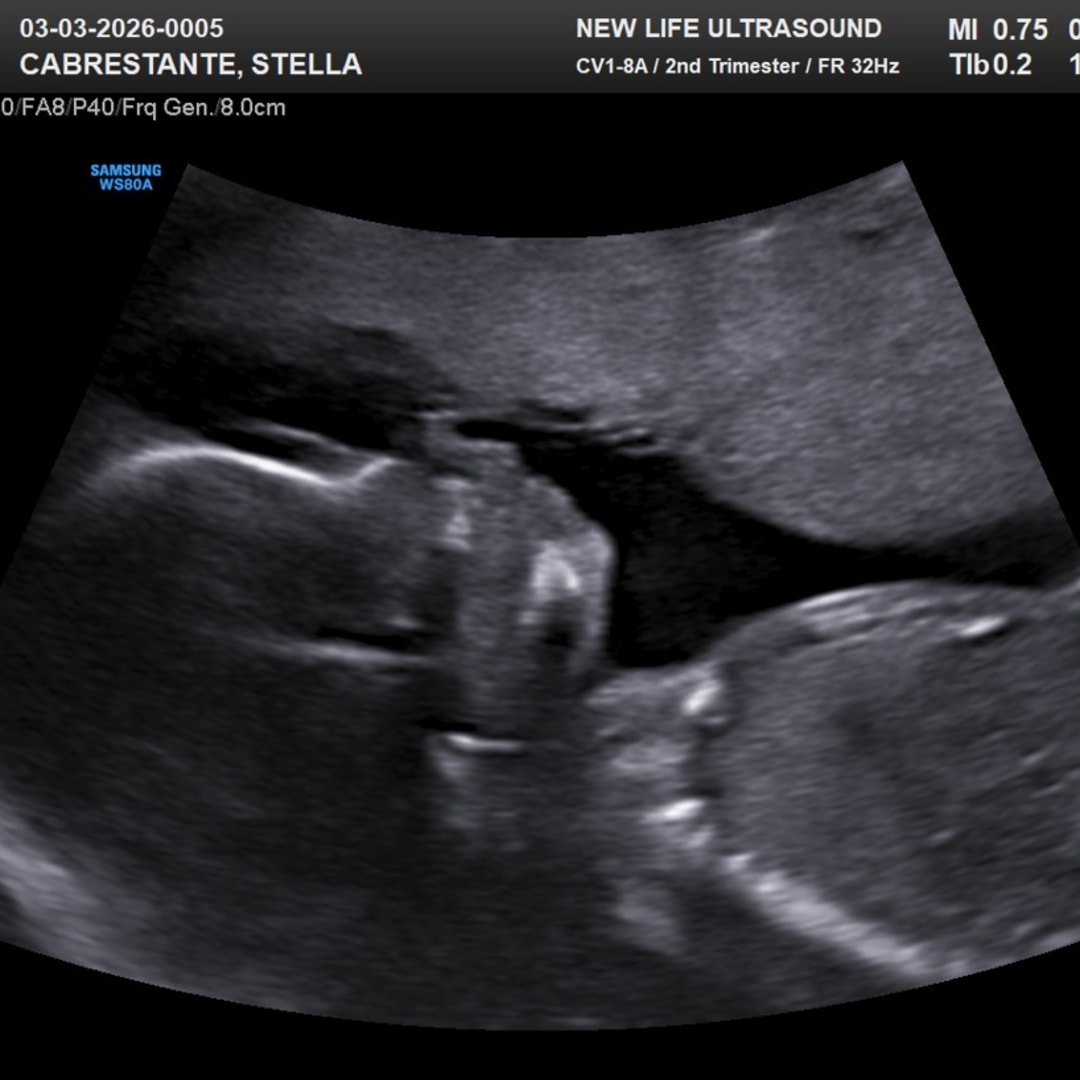 Photo shared by Stella for their Babylist baby registry.