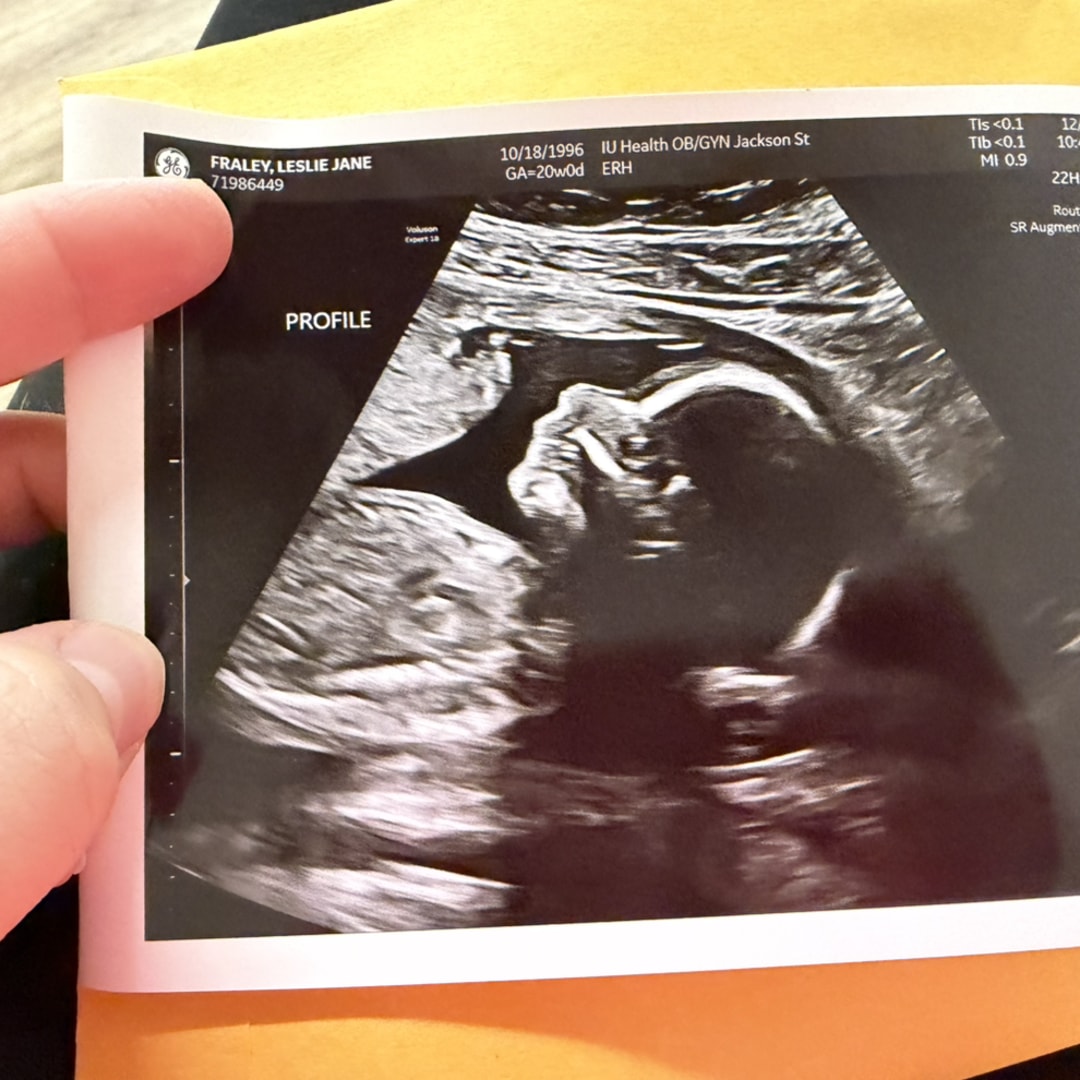 Photo shared by Leslie for their Babylist baby registry.