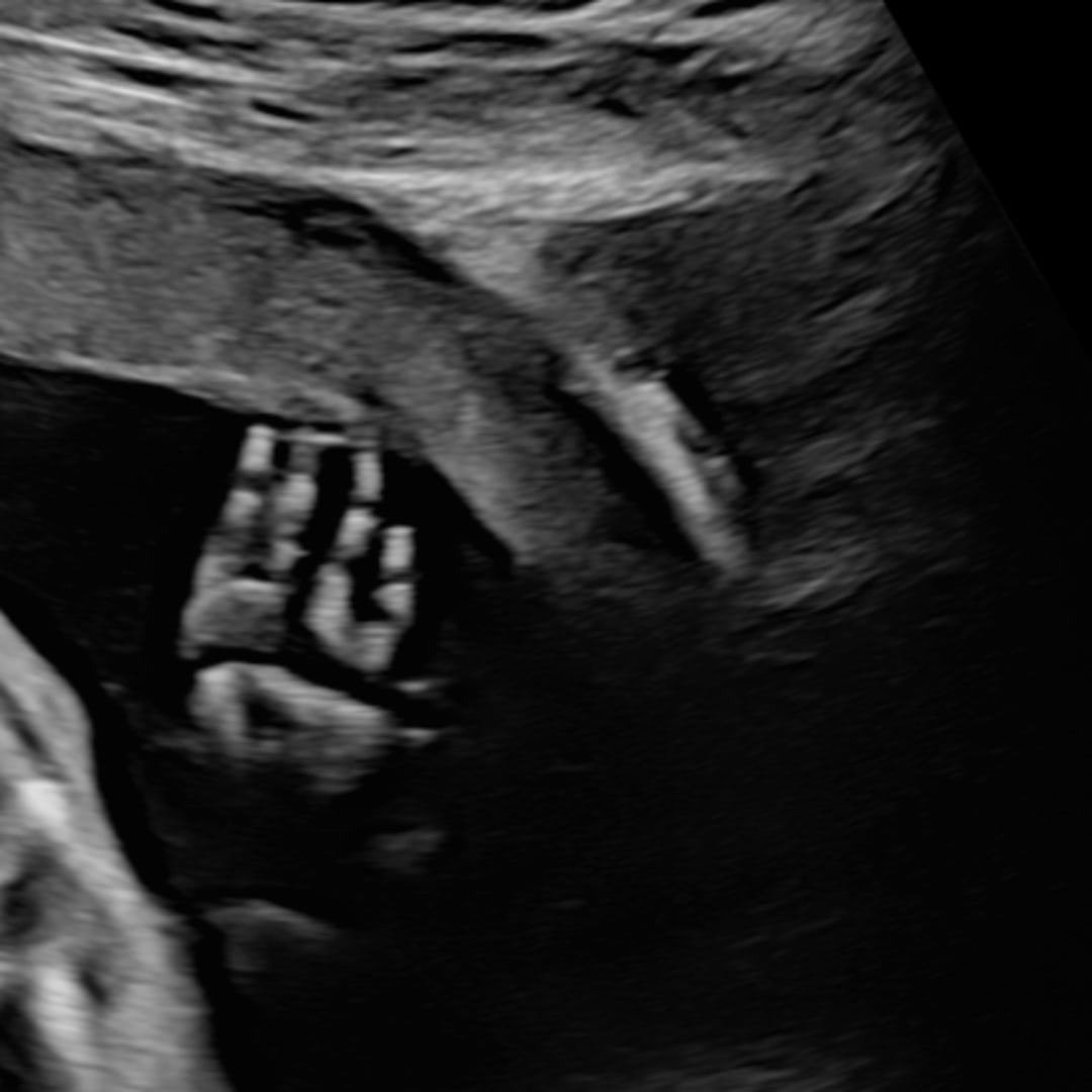 Photo shared by Payton for their Babylist baby registry.