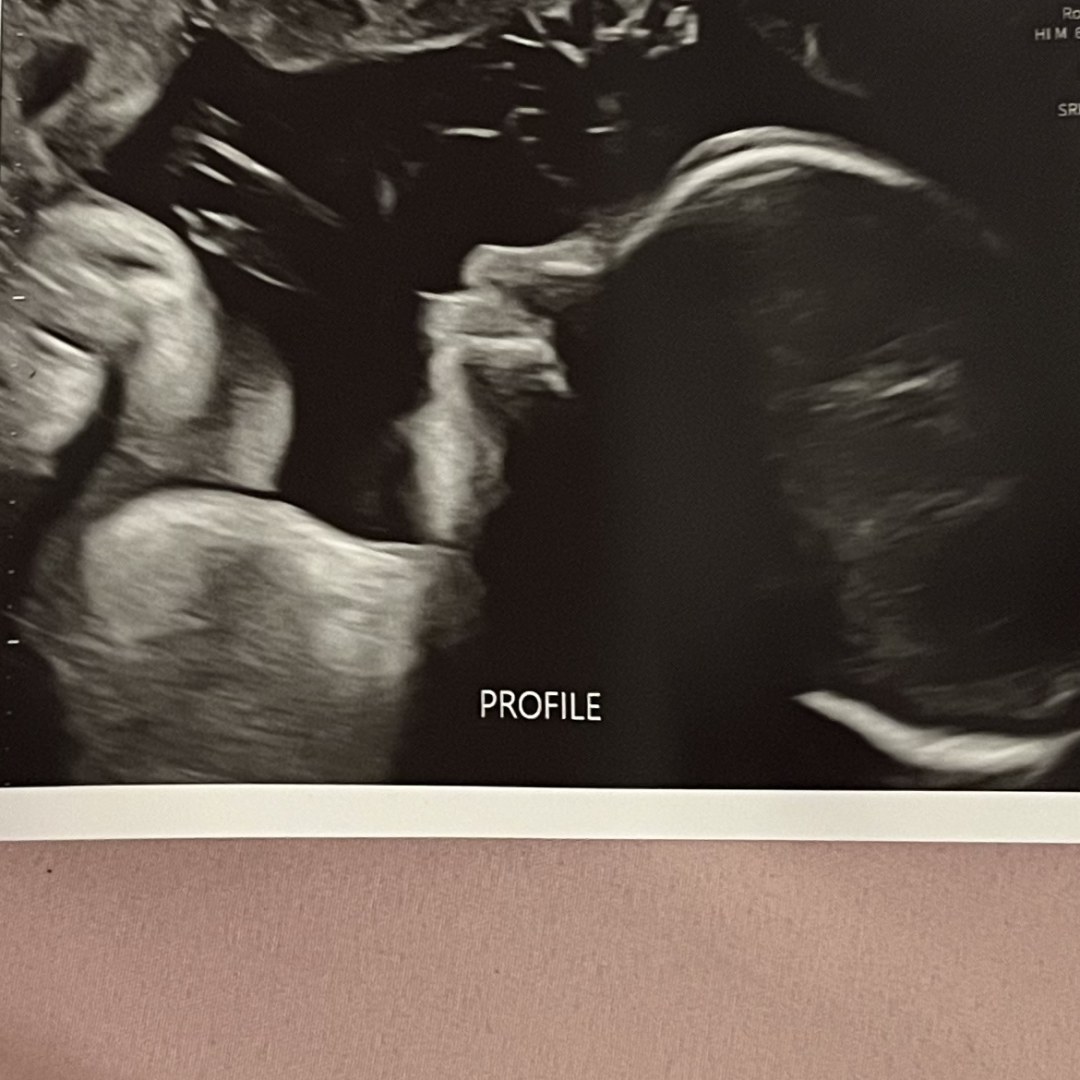 Photo shared by Jenna for their Babylist baby registry.
