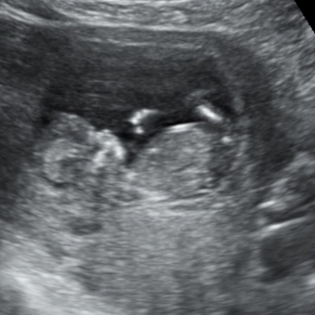 Photo shared by Carly for their Babylist baby registry.