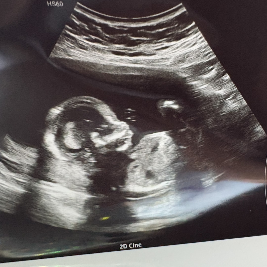 Photo shared by Brooke for their Babylist baby registry.