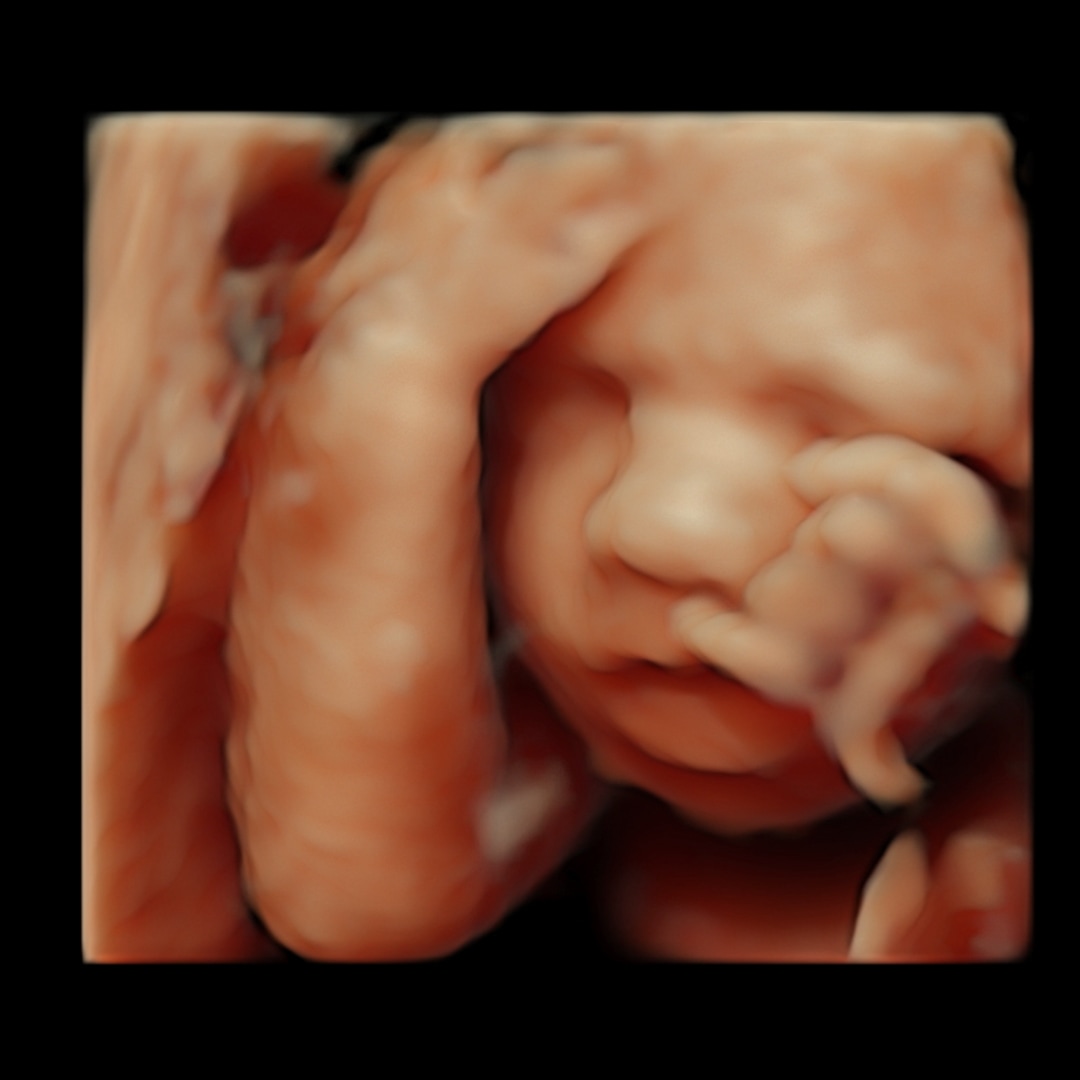 Photo shared by Hannah for their Babylist baby registry.