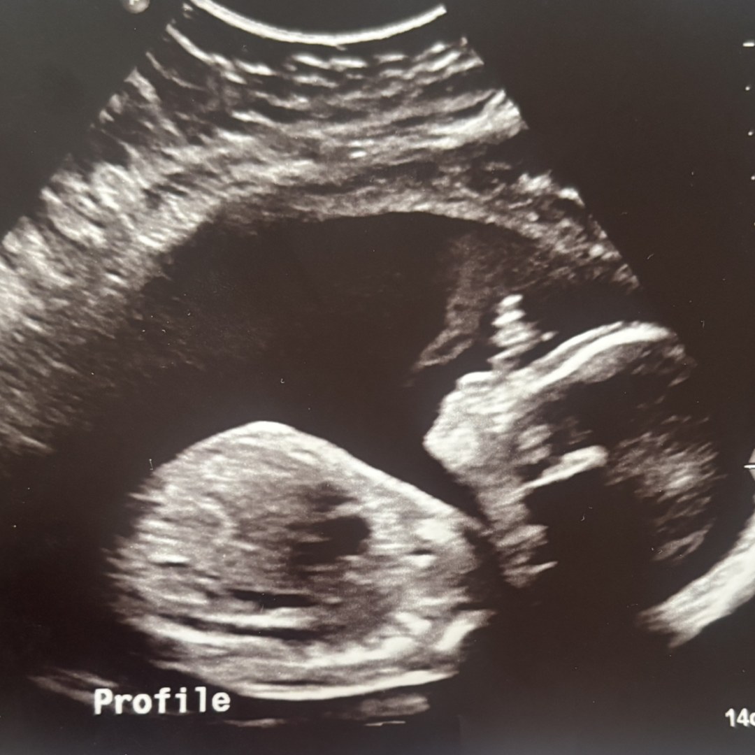 Photo shared by Mariah & Kyman for their Babylist baby registry.
