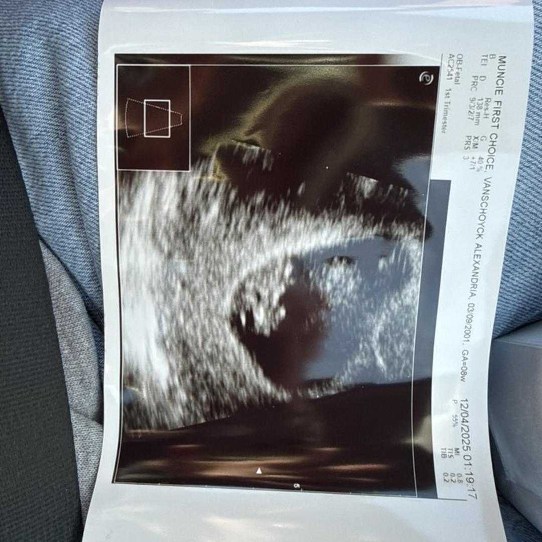 Photo shared by Alexandria for their Babylist baby registry.