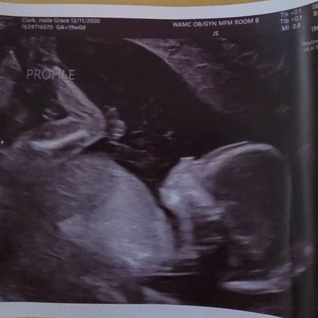 Photo shared by Halle for their Babylist baby registry.