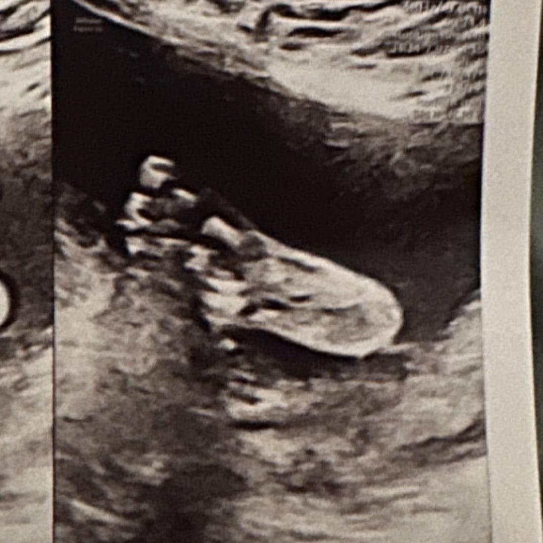 Photo shared by Kendra for their Babylist baby registry.