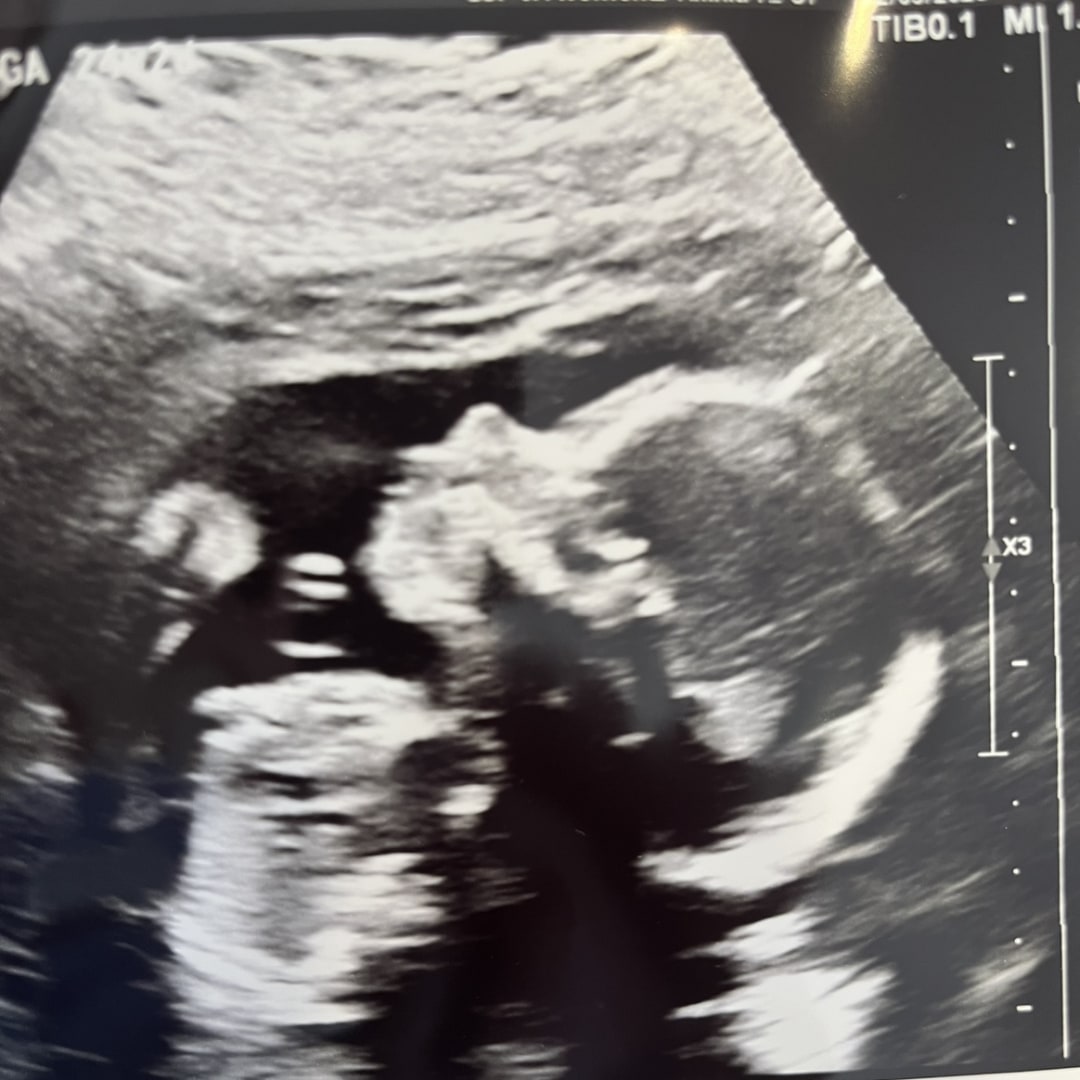 Photo shared by Maggie for their Babylist baby registry.