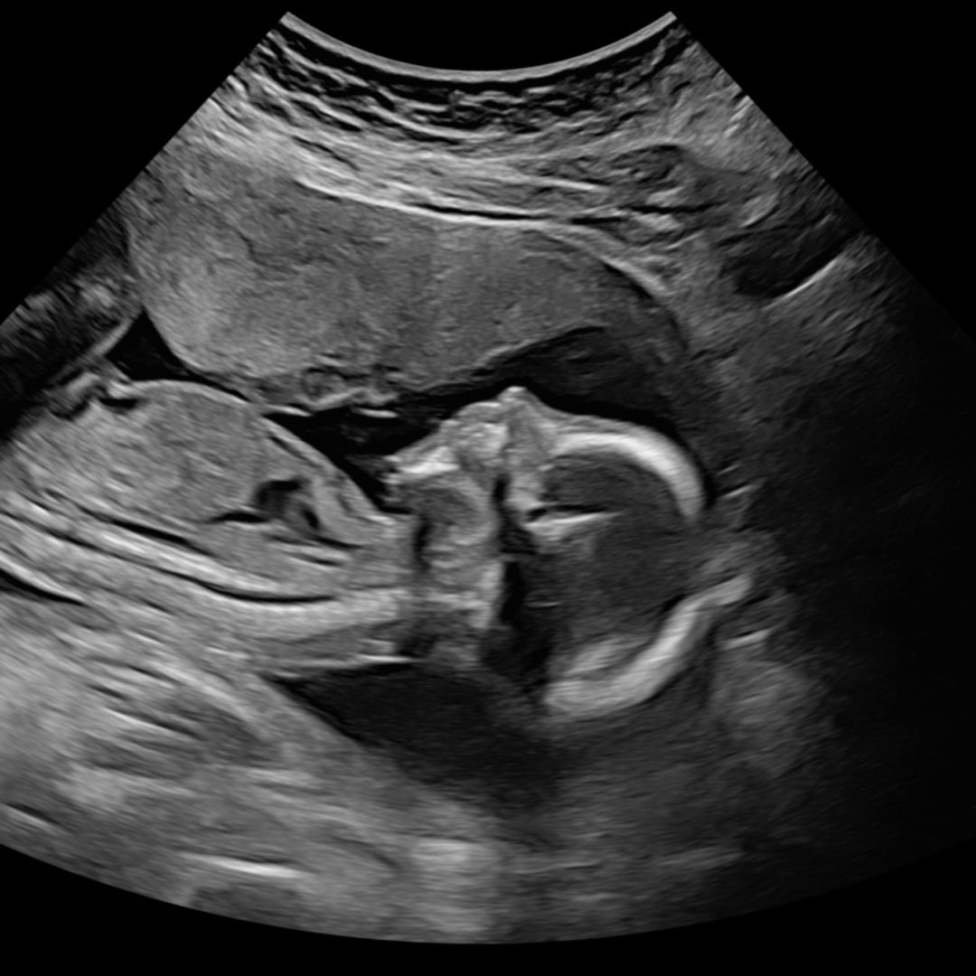 Photo shared by Jayleen for their Babylist baby registry.