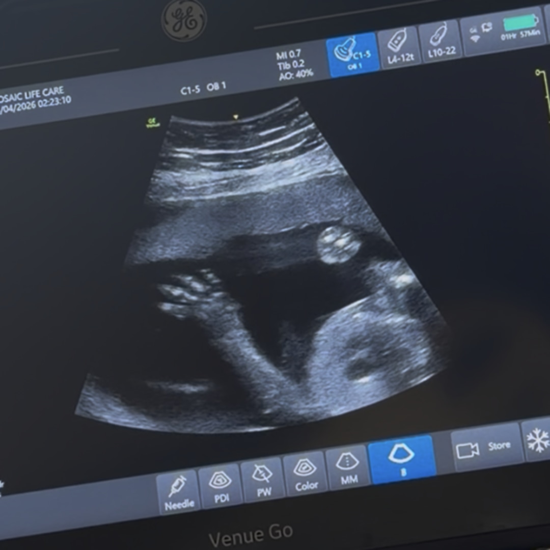 Photo shared by Myah for their Babylist baby registry.