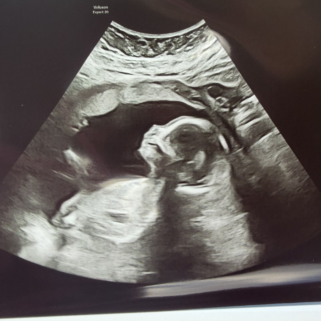 Photo shared by Sara for their Babylist baby registry.