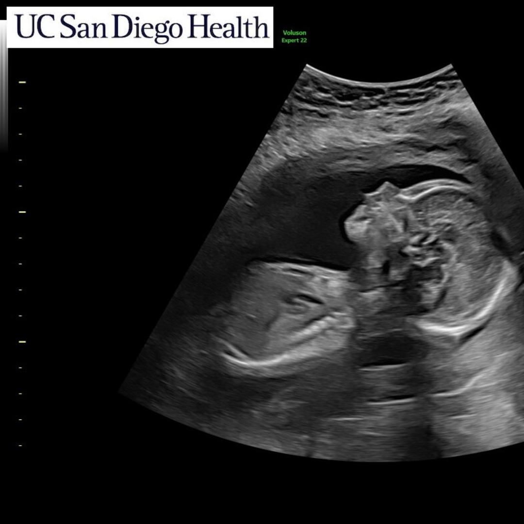 Photo shared by Ximena for their Babylist baby registry.