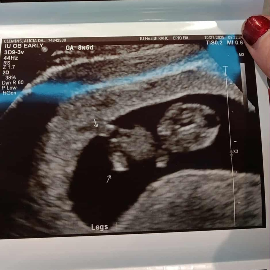 Photo shared by Alicia for their Babylist baby registry.