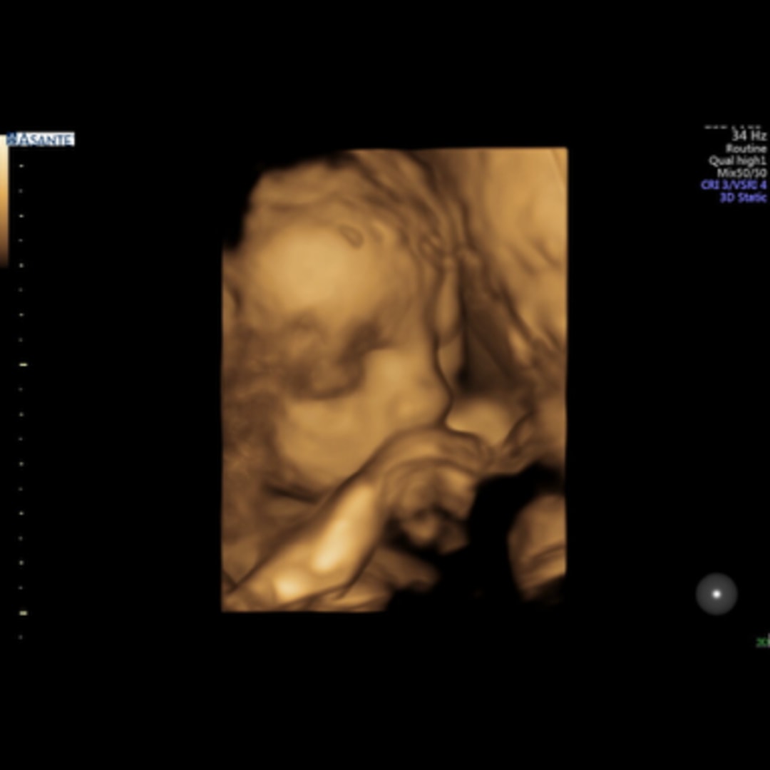 Photo shared by Gabrielle for their Babylist baby registry.