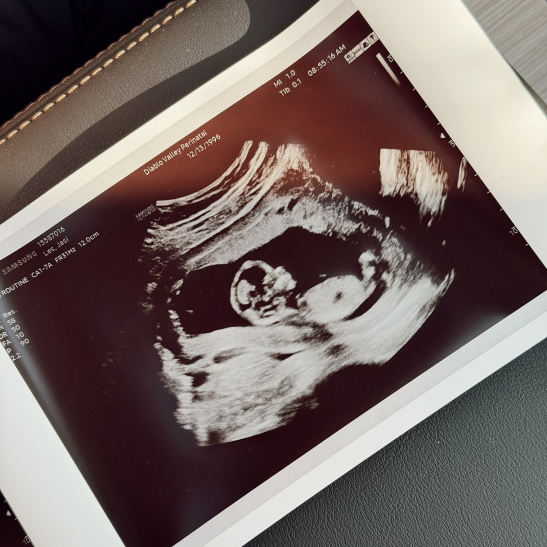 Photo shared by Jasi for their Babylist baby registry.