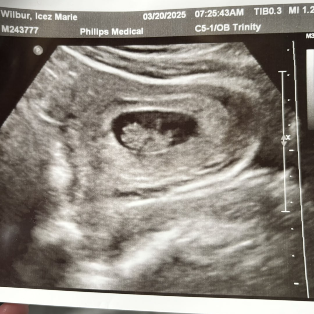 Photo shared by Icez for their Babylist baby registry.