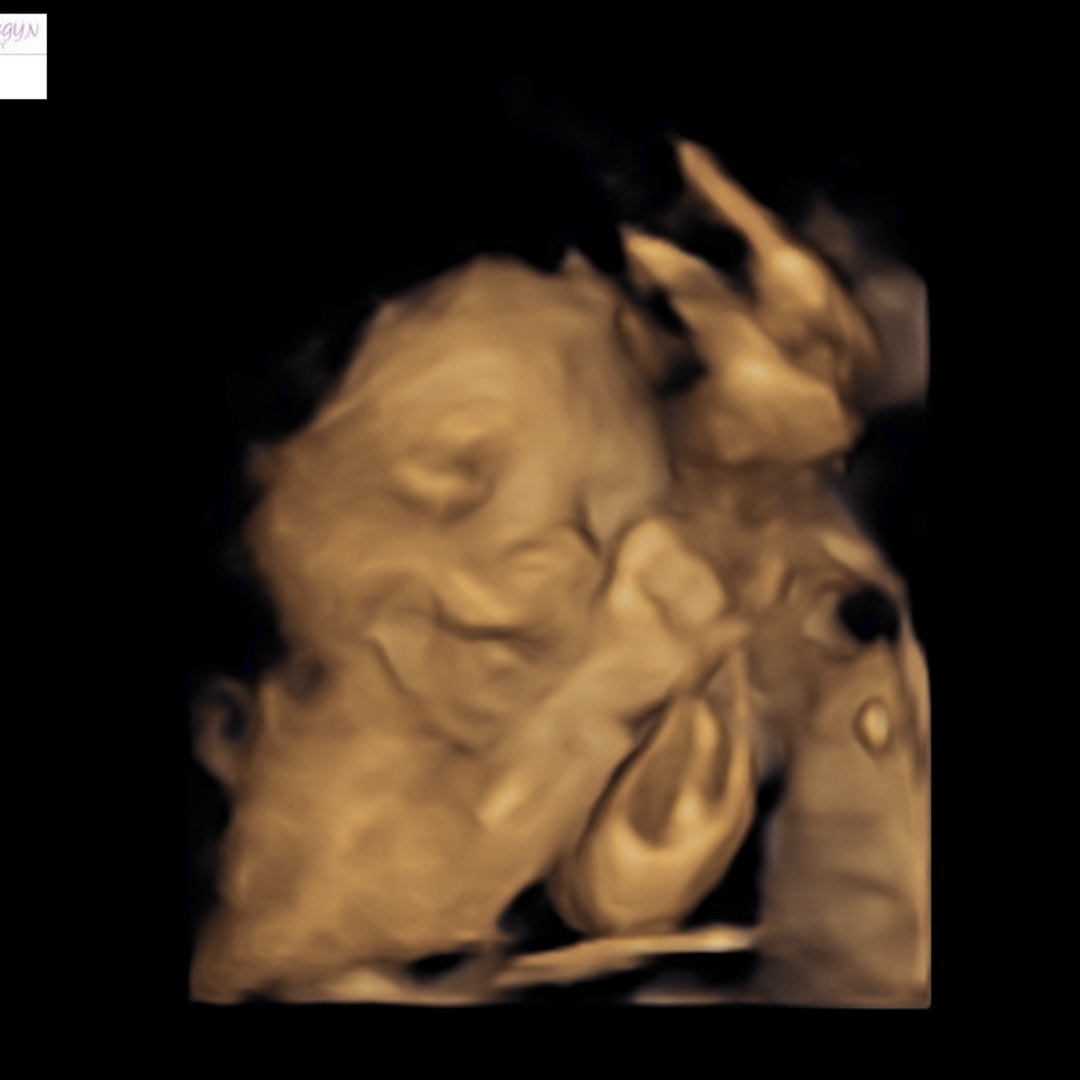 Photo shared by Macie for their Babylist baby registry.