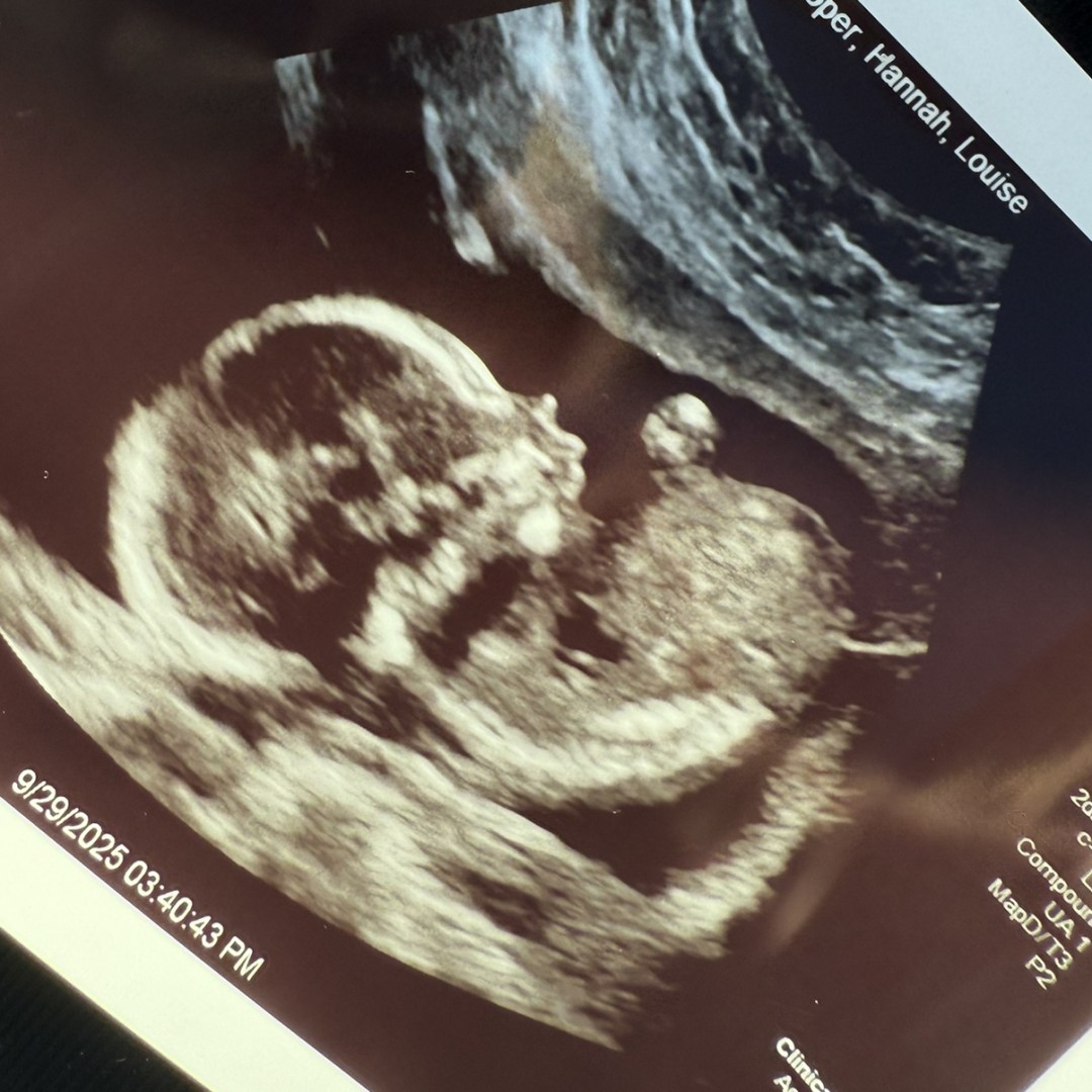 Photo shared by Hannah for their Babylist baby registry.