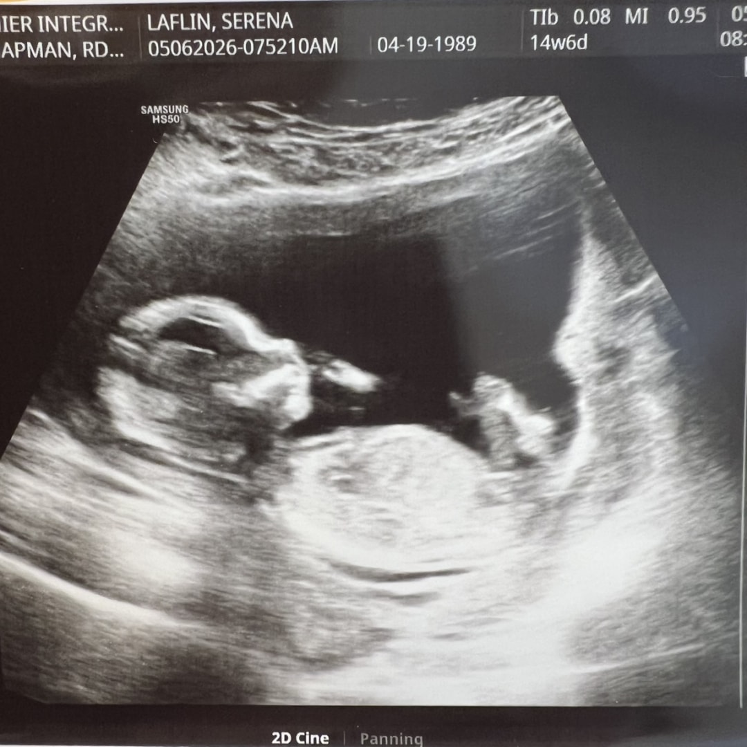 Photo shared by Serena for their Babylist baby registry.