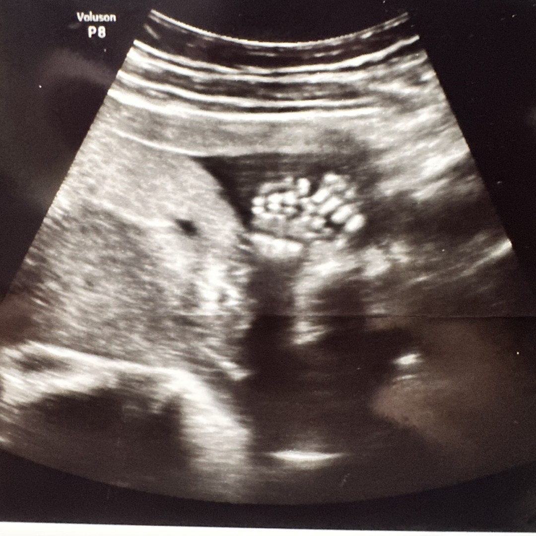 Photo shared by Daisy for their Babylist baby registry.