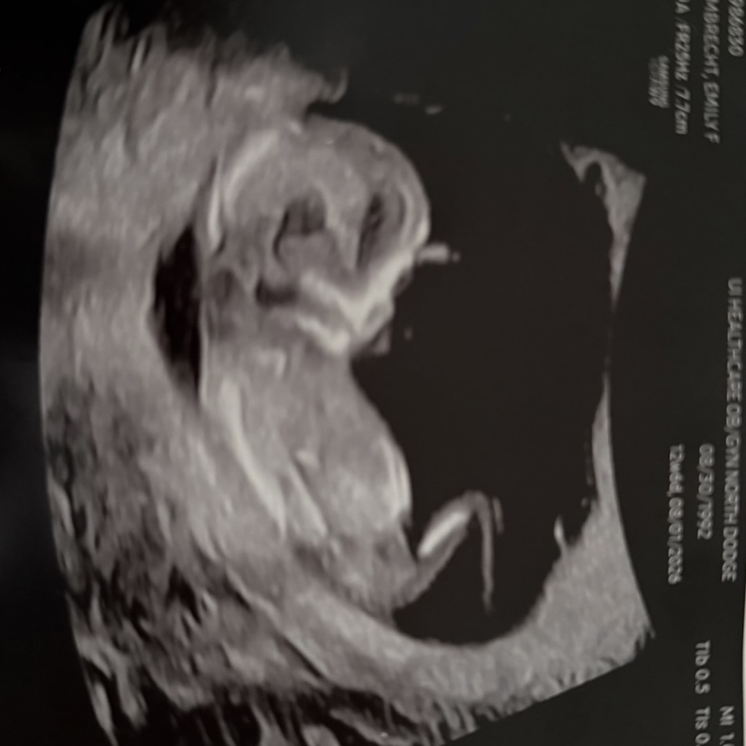 Photo shared by Emily for their Babylist baby registry.