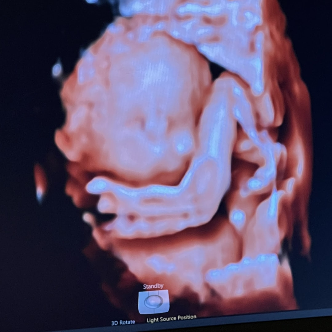 Photo shared by Suzi & Ron for their Babylist baby registry.