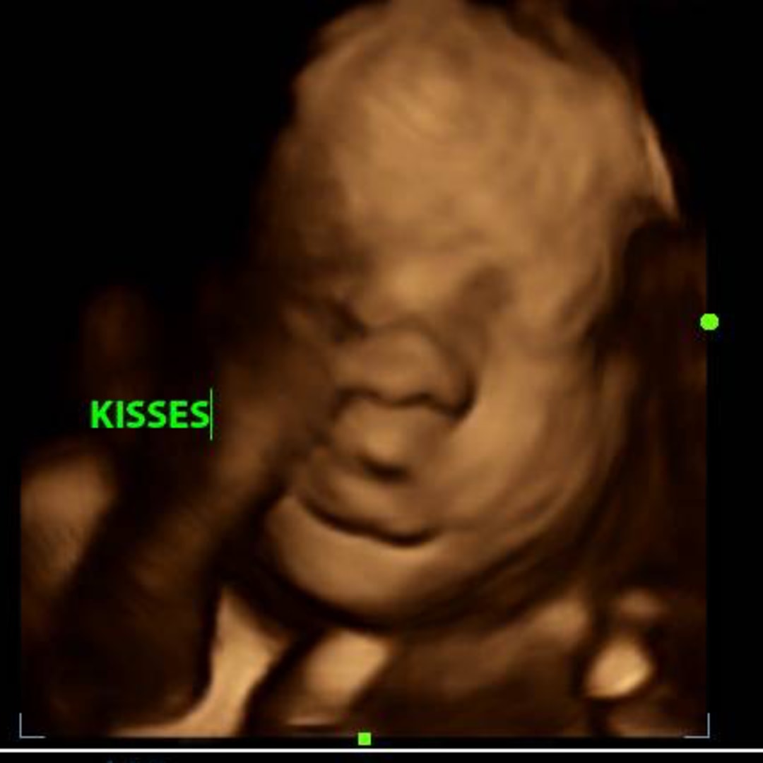 Photo shared by Brianna for their Babylist baby registry.