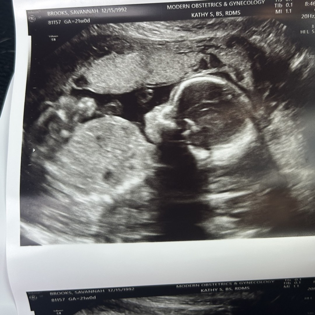 Photo shared by Savannah for their Babylist baby registry.