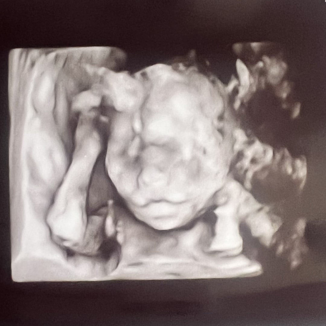 Photo shared by Lauren for their Babylist baby registry.