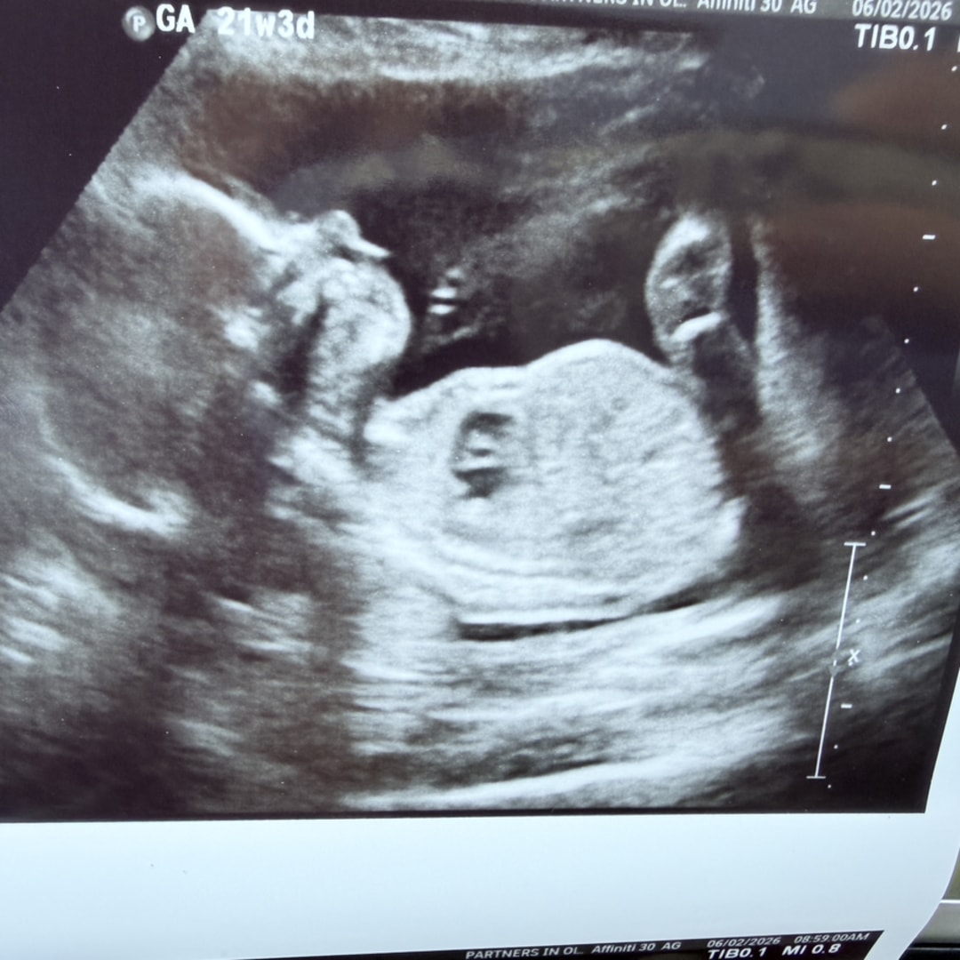 Photo shared by Cassidy for their Babylist baby registry.