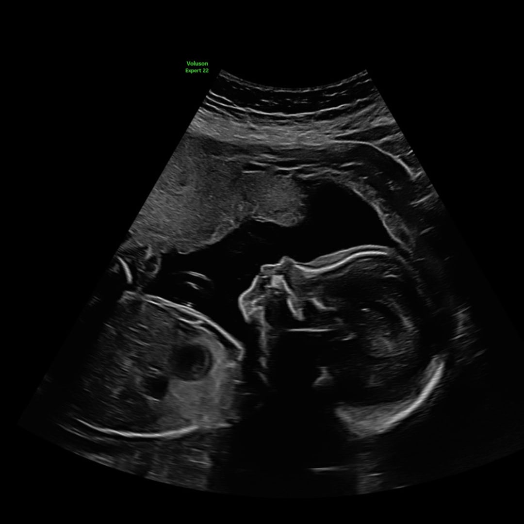 Photo shared by Nathalie for their Babylist baby registry.
