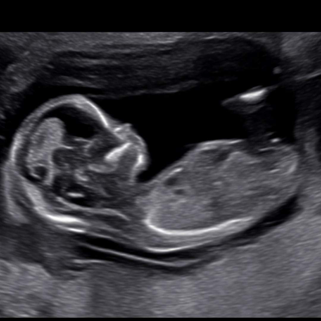 Photo shared by Francesca for their Babylist baby registry.