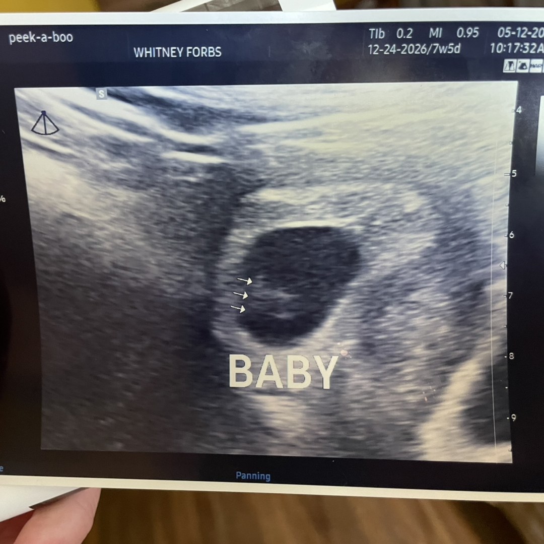 Photo shared by Whitney for their Babylist baby registry.