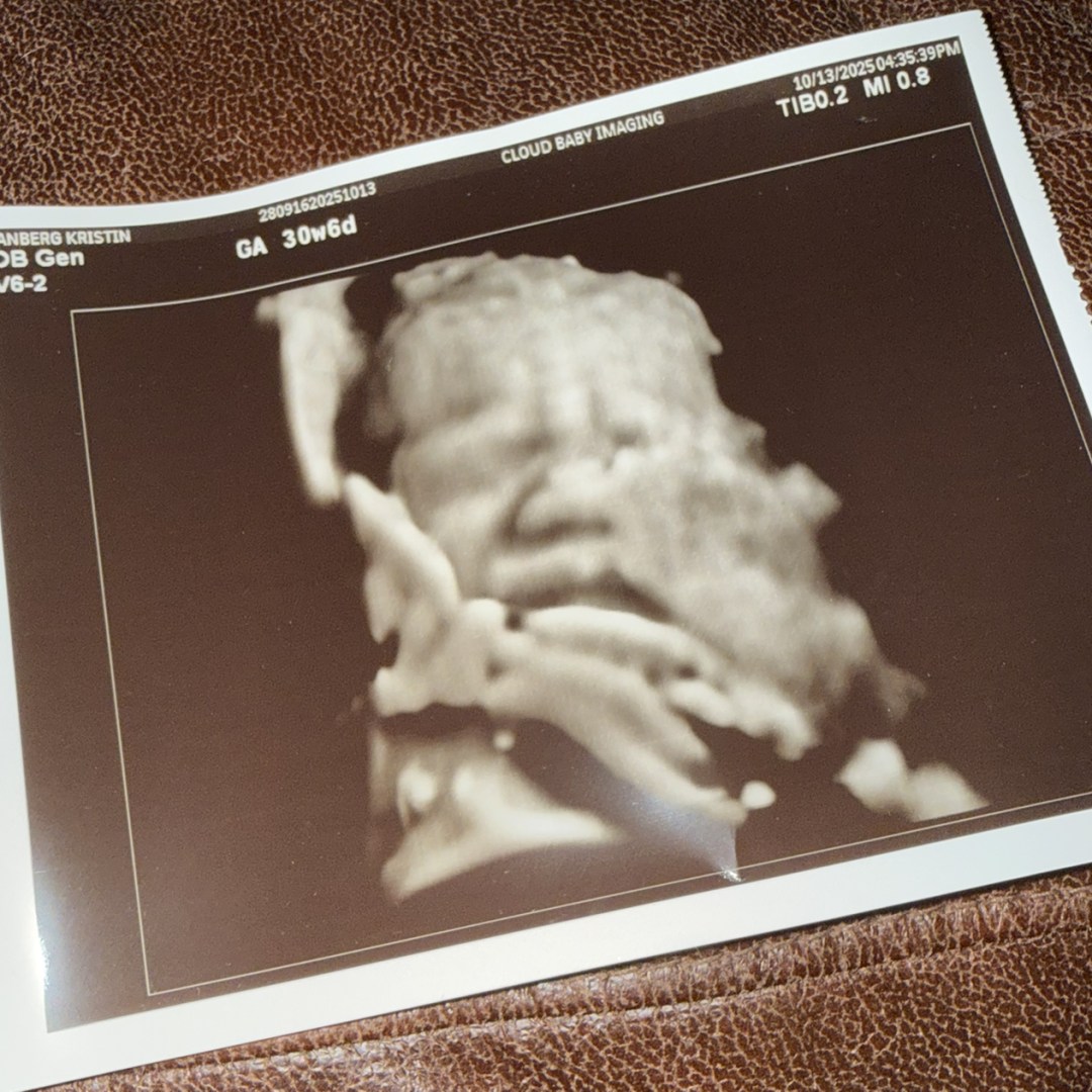 Photo shared by Kristin for their Babylist baby registry.