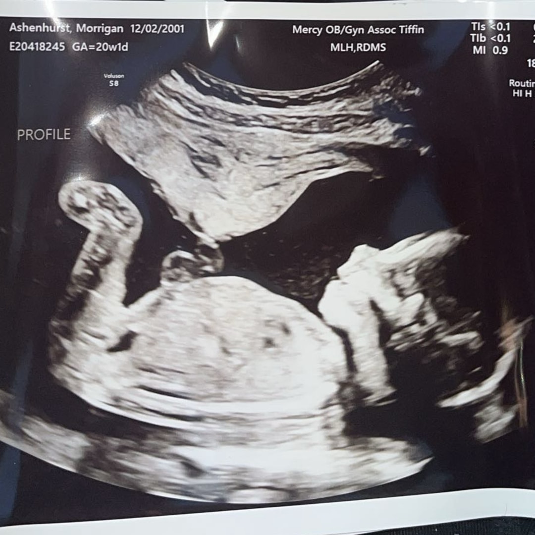 Photo shared by Morrigan for their Babylist baby registry.