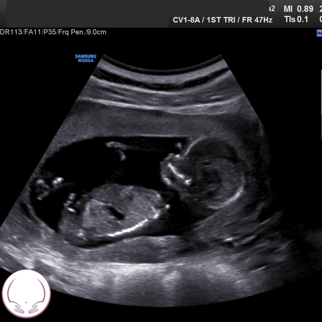 Photo shared by Sydney for their Babylist baby registry.