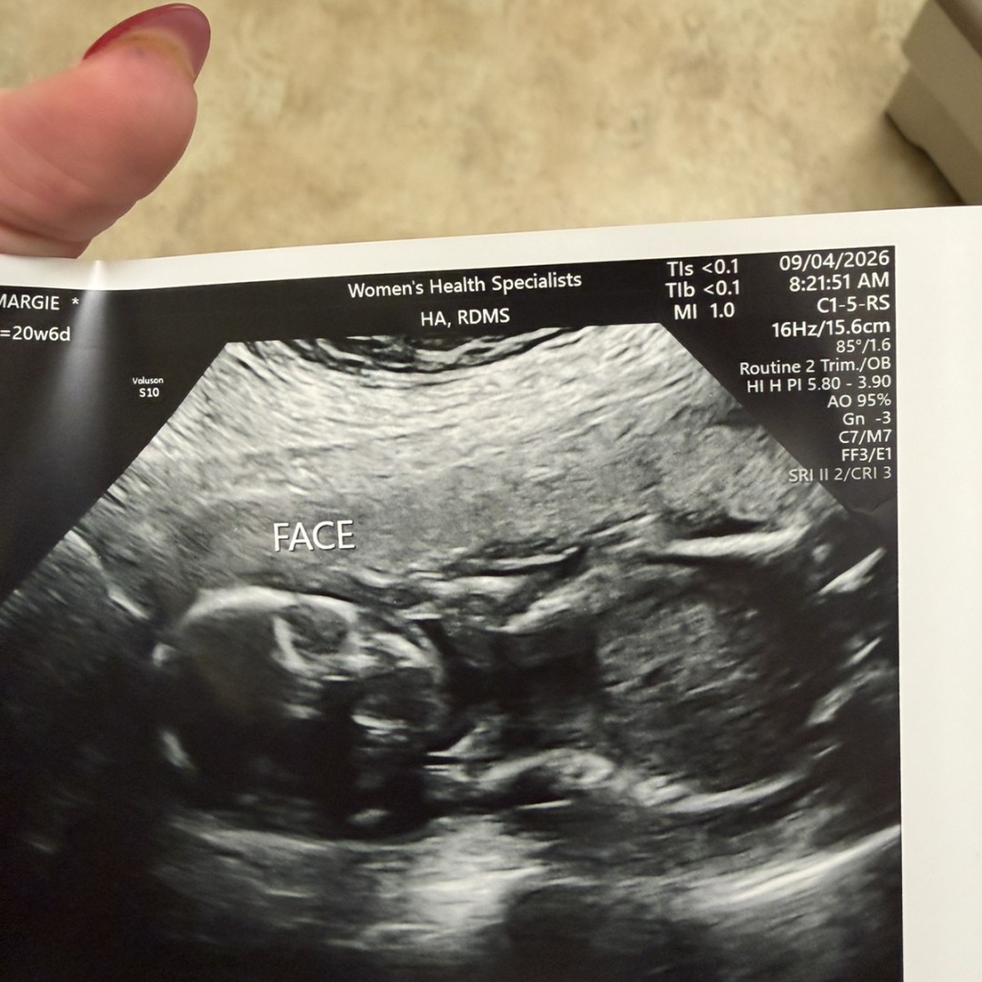 Photo shared by Margie for their Babylist baby registry.