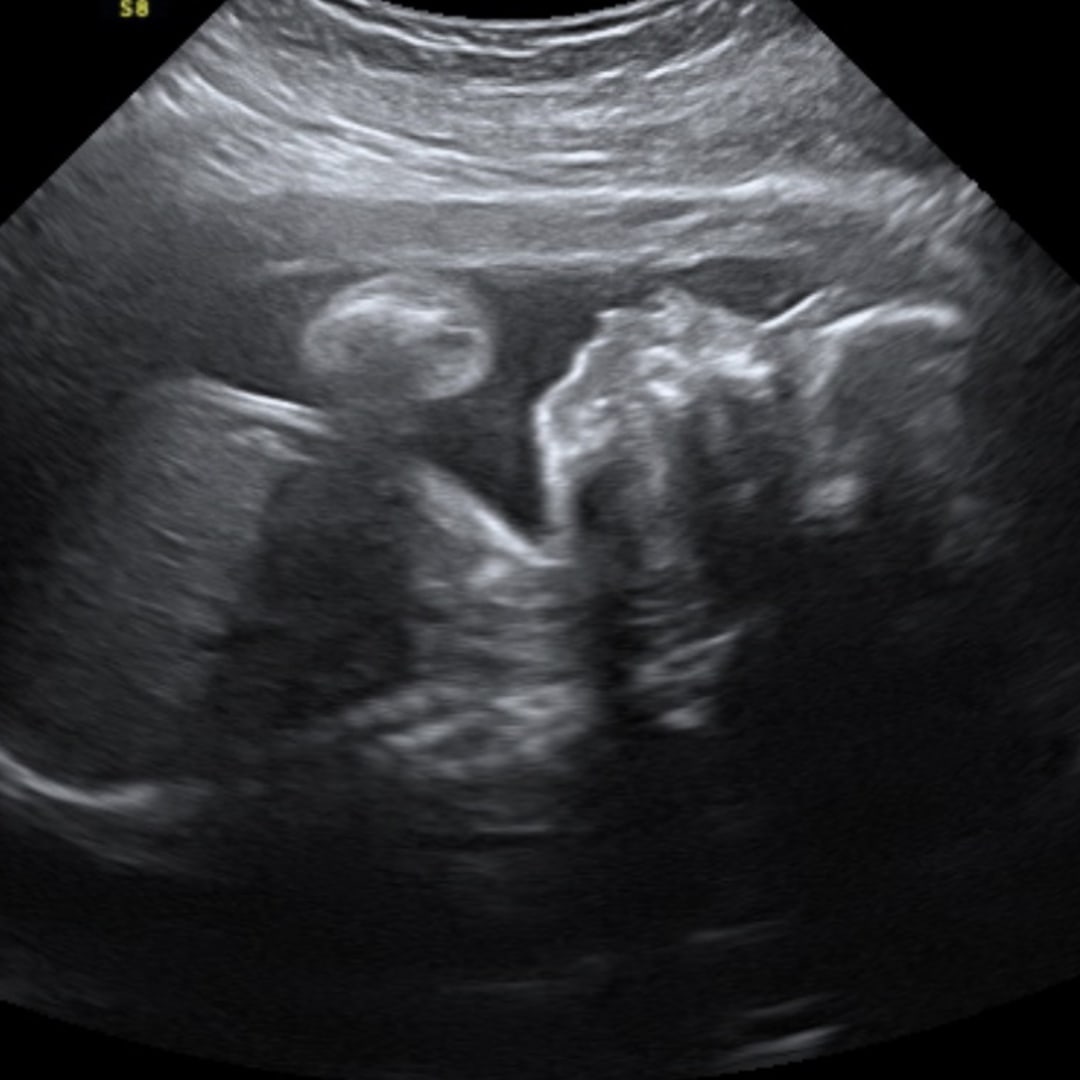Photo shared by Martie for their Babylist baby registry.