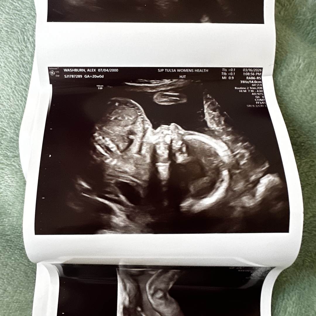 Photo shared by Alex for their Babylist baby registry.