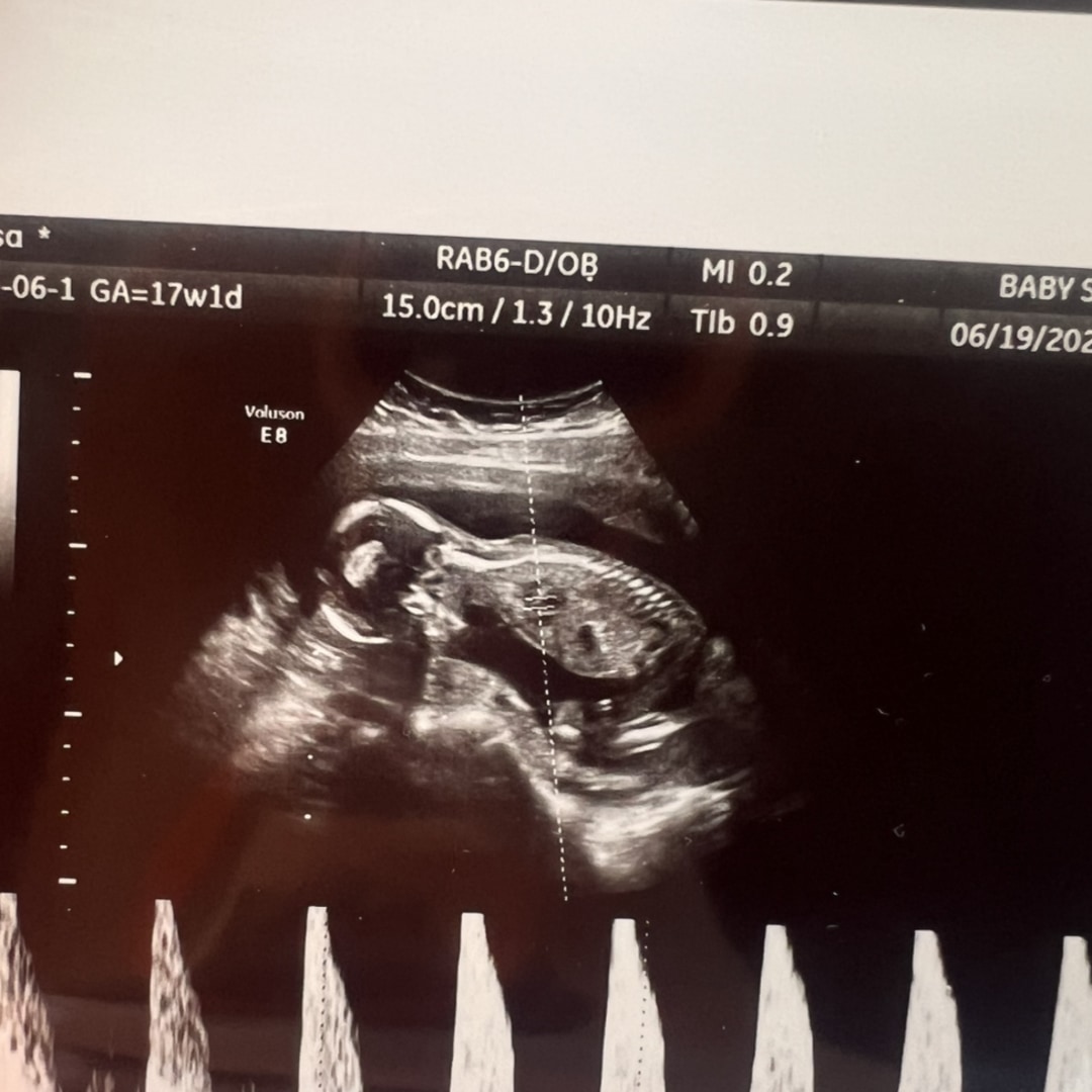 Photo shared by Melissa for their Babylist baby registry.