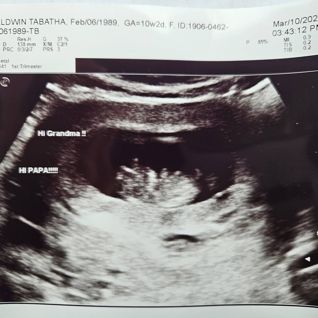 Photo shared by Tabatha for their Babylist baby registry.