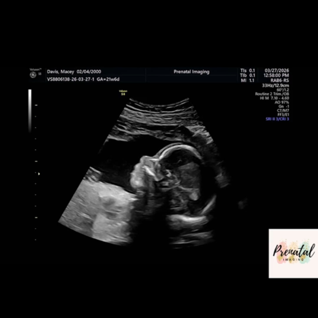 Photo shared by Macey for their Babylist baby registry.