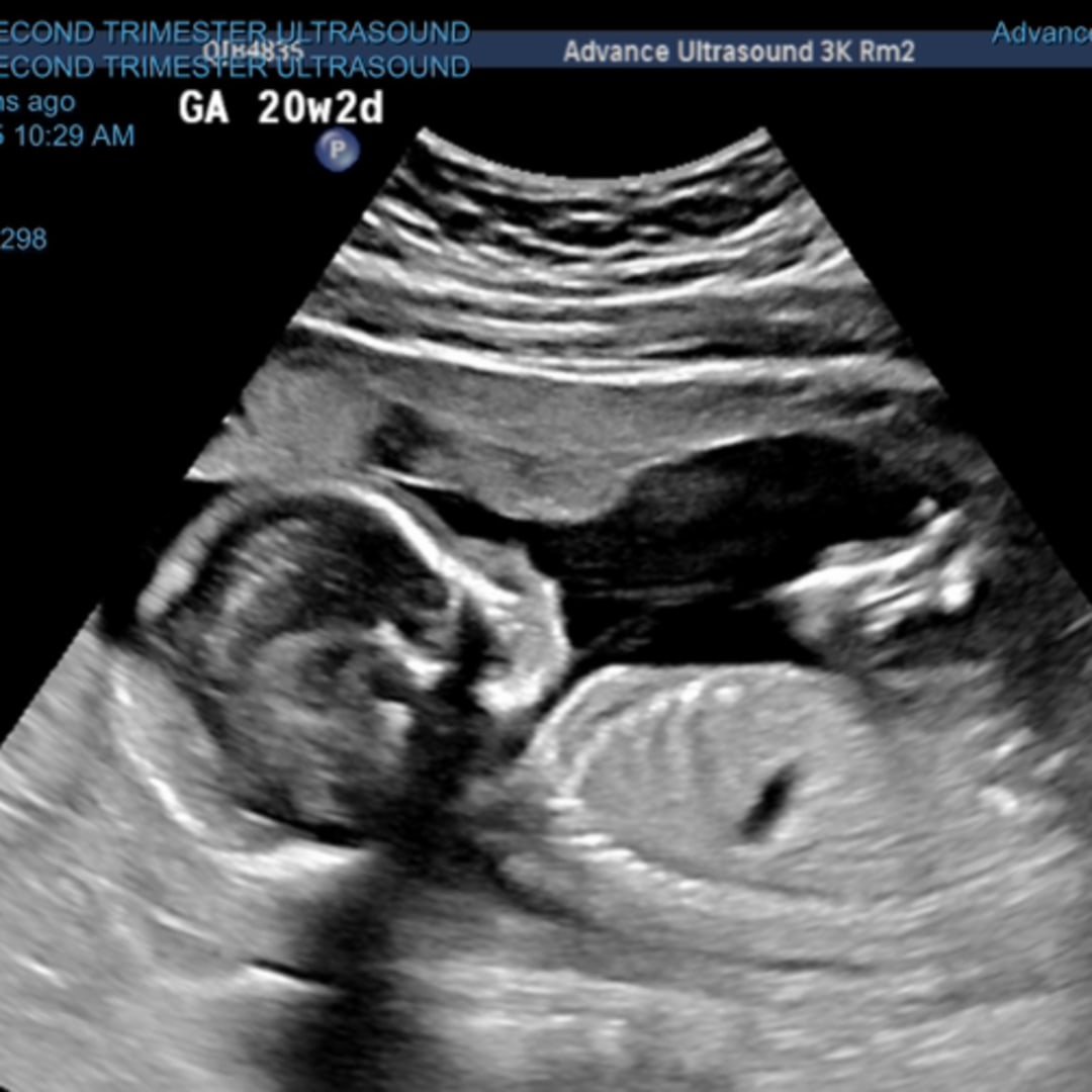 Photo shared by Ueiti for their Babylist baby registry.