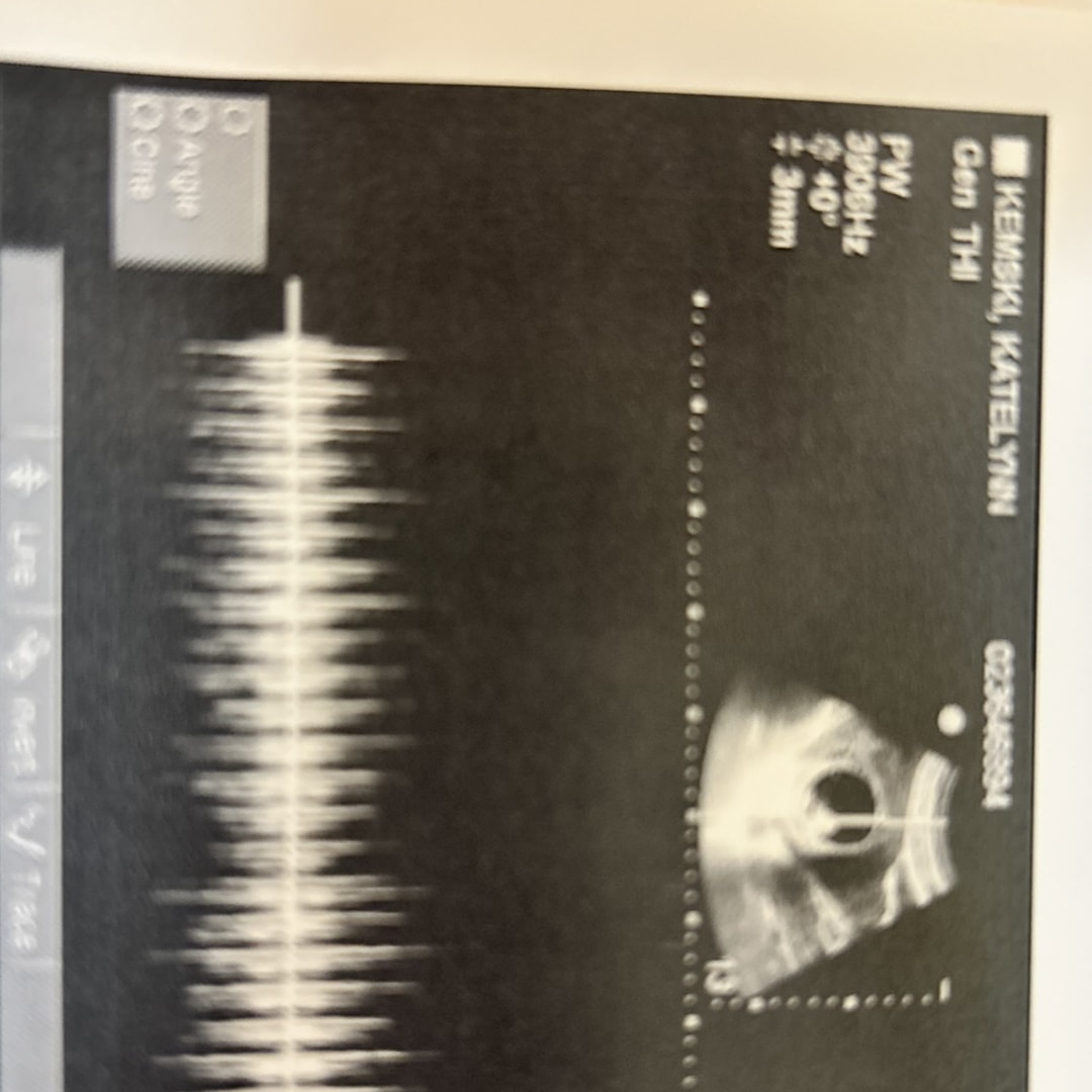 Photo shared by Katelynn for their Babylist baby registry.